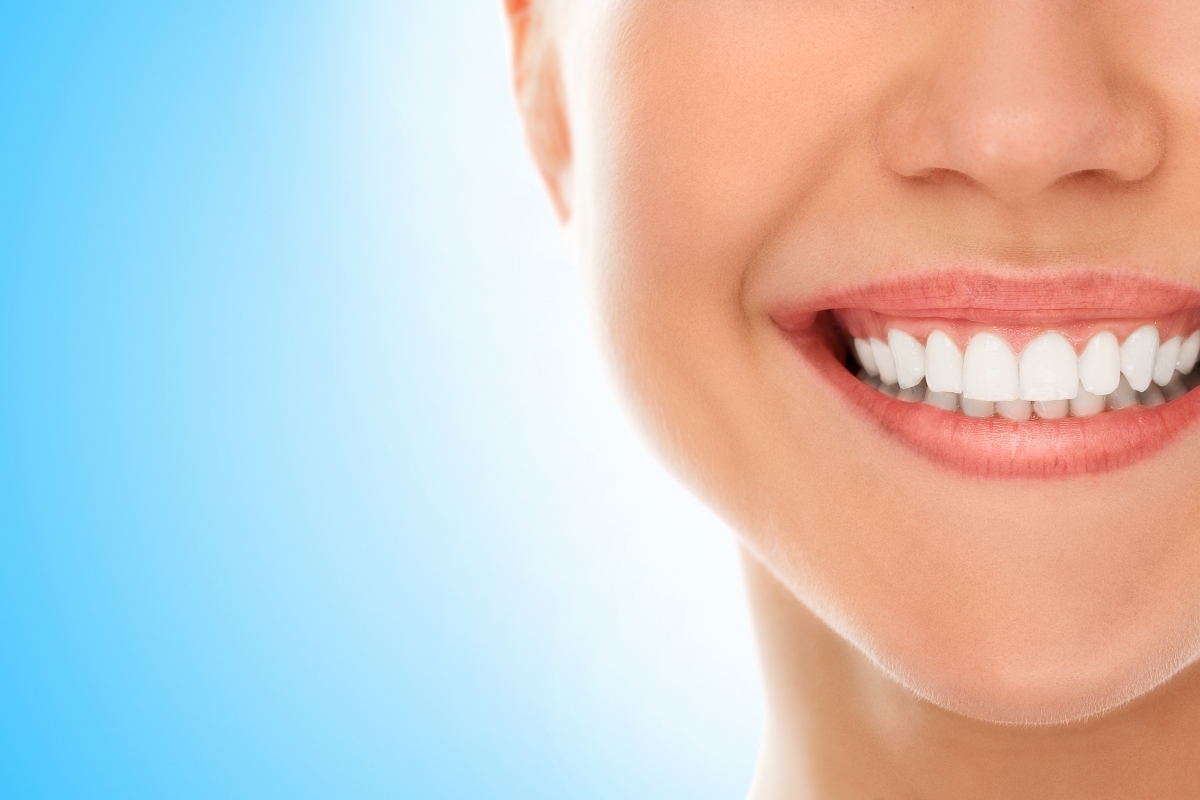 Как осуществляется эстетическая реставрация зубов?